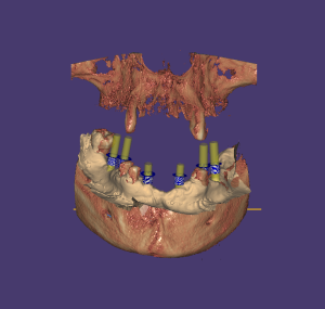 Captura Exoplan 2 Captura Exoplan 2