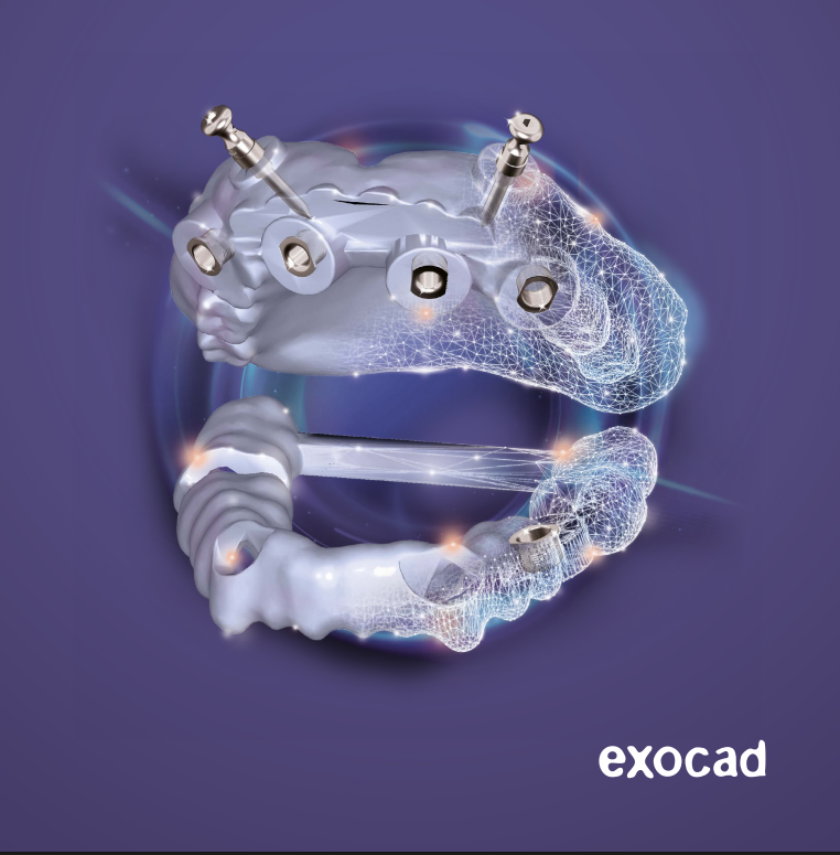 Esta en flujo exocad exoplan Esta en flujo exocad exoplan